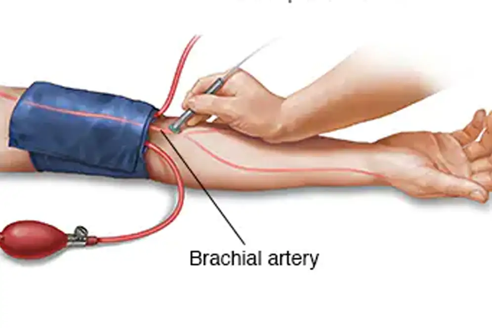 This is an image of an Ankle Brachial Index.